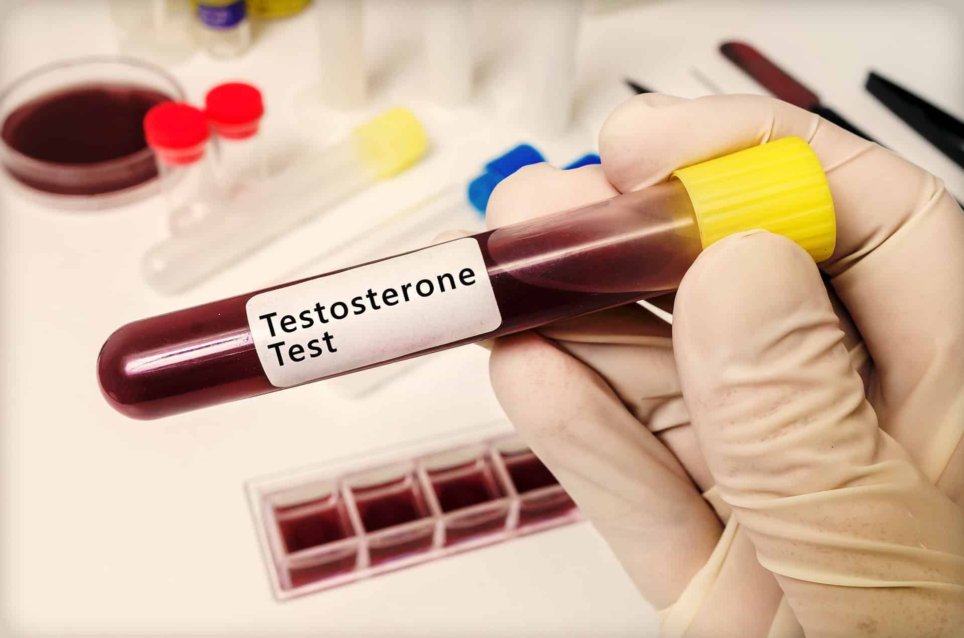 Testosterone test kit home blood test